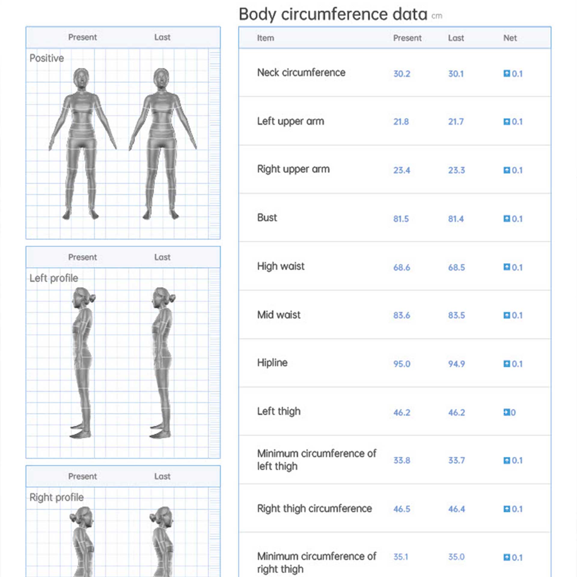 3D-Körperscanner